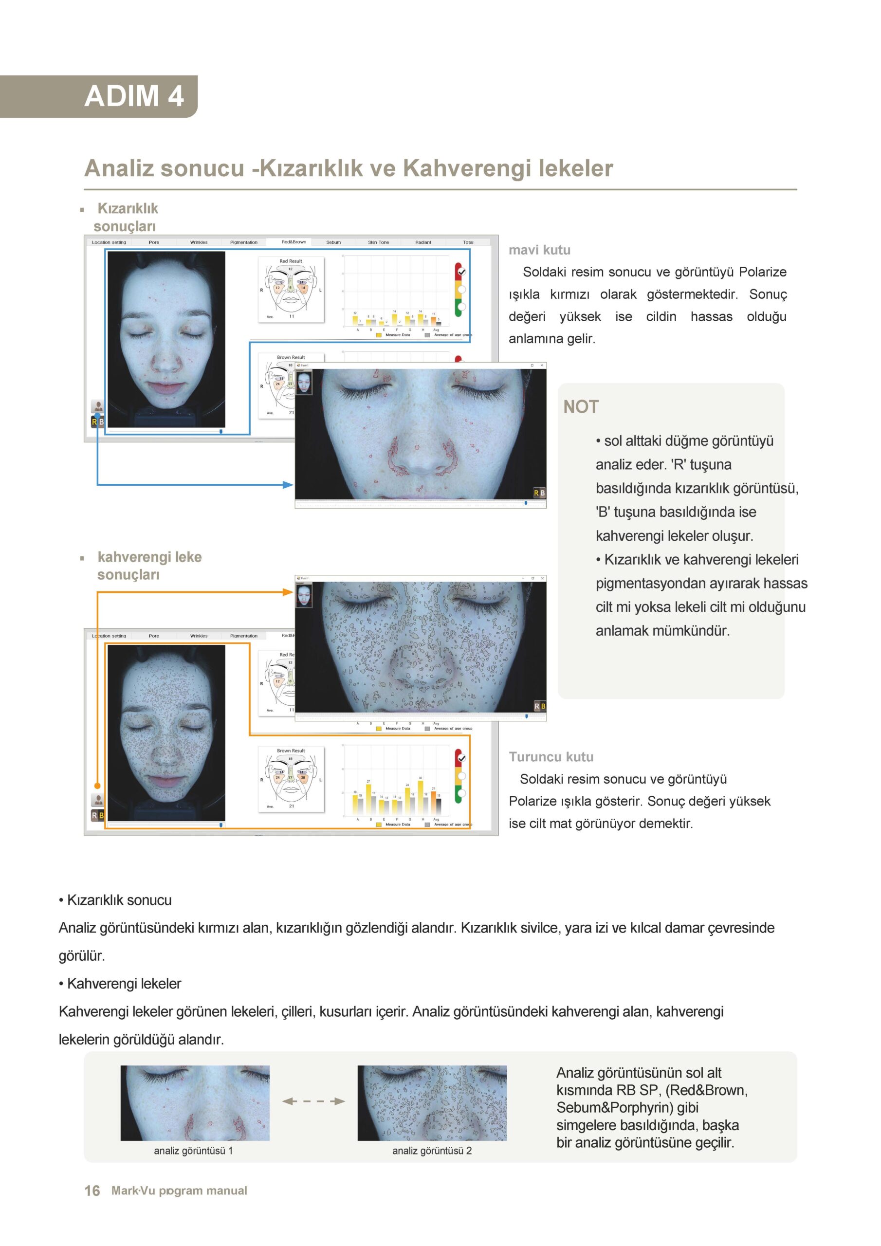 cilt analiz cihazı - 15