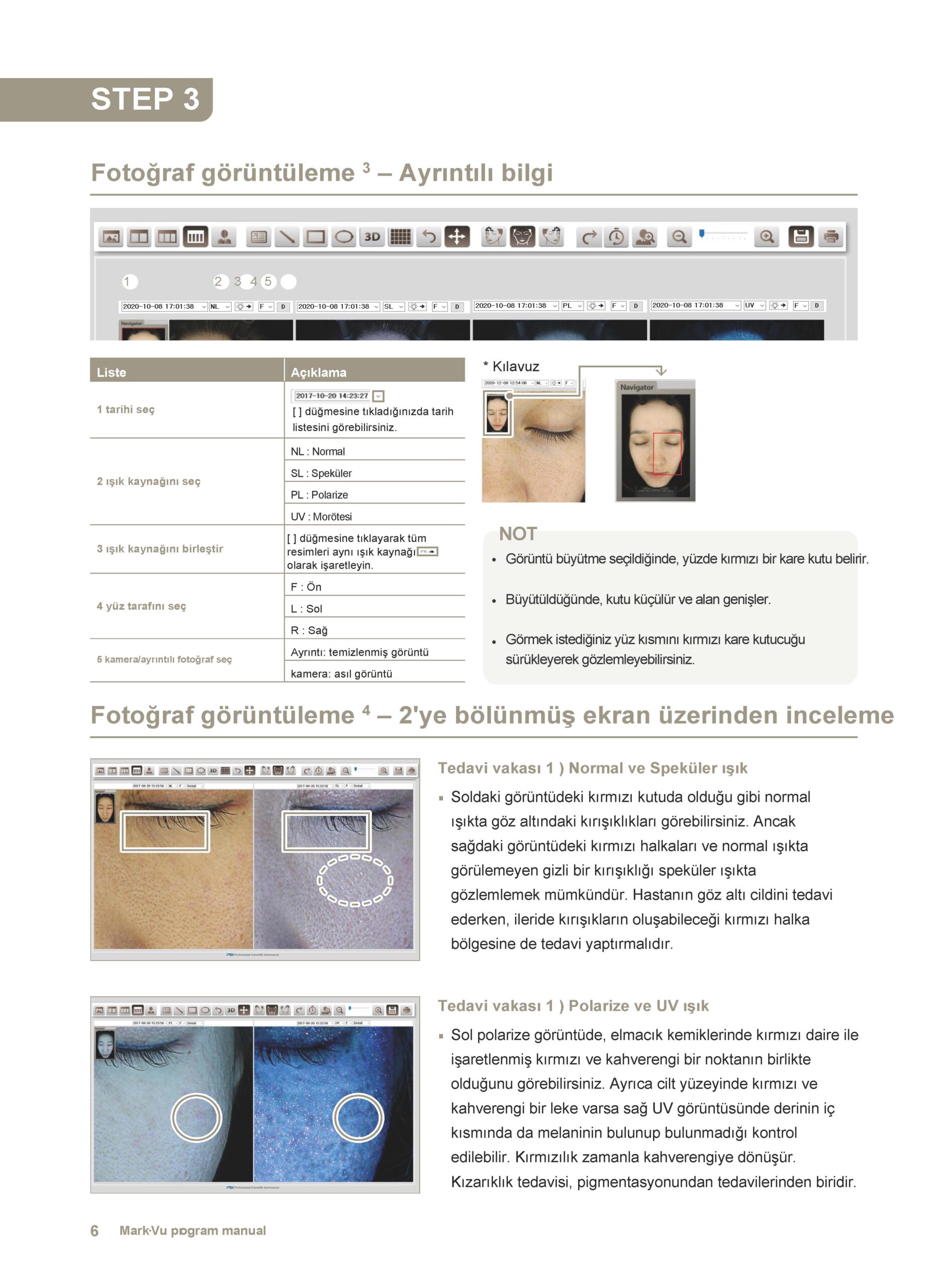 cilt analiz cihazı - 5