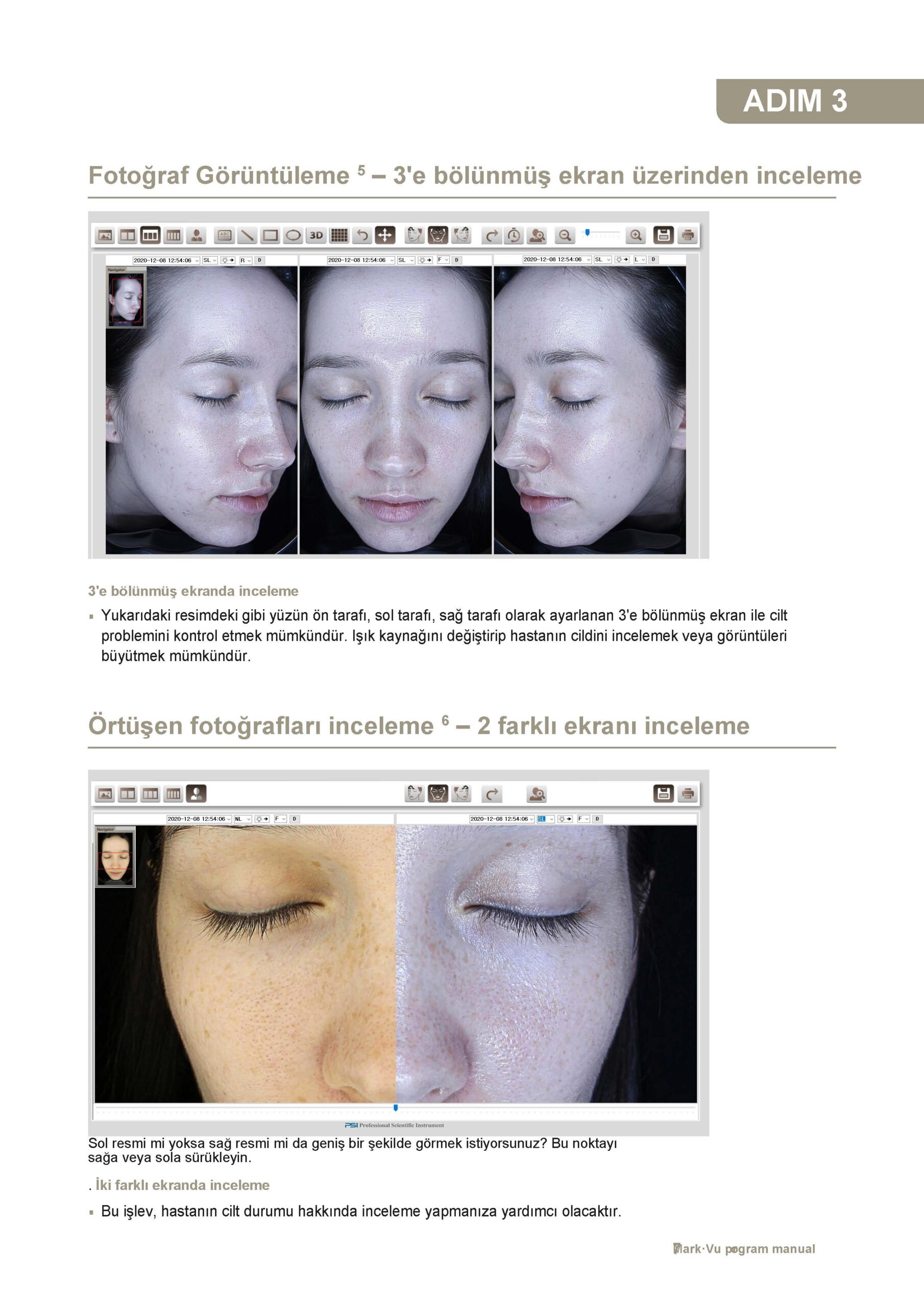 cilt analiz cihazı - 6